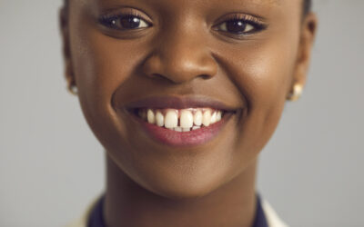 Diastema dentale: cos’è