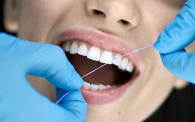 Pulizia dei denti: ogni quanto farla