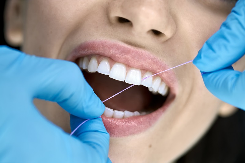 Pulizia dei denti: ogni quanto farla