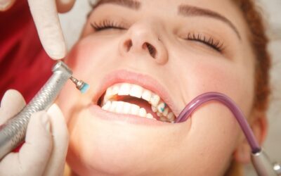 Come si usa lo scovolino per denti