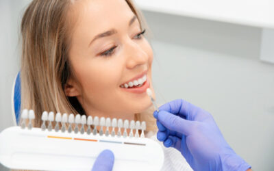 Faccette Dentali: Innovazione e Rivoluzione per il tuo sorriso