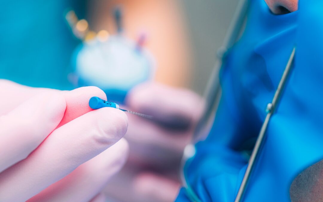 Endodonzia – trattamento della polpa e del canale radicolare